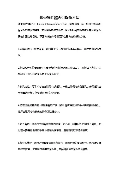 锁骨弹性髓内钉操作方法