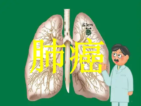 肺癌的诊断与治疗演示幻灯片