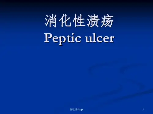 《消化性溃疡》PPT课件 (2)