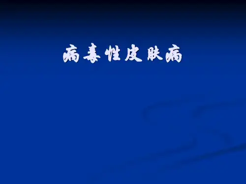 病毒性皮肤病