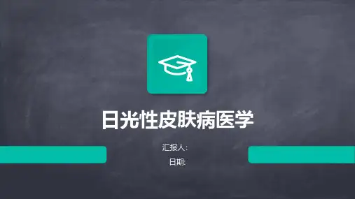 日光性皮肤病医学