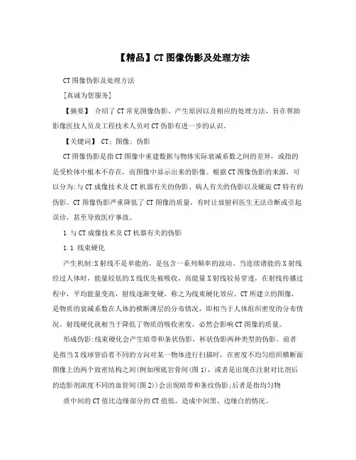 【精品】CT图像伪影及处理方法