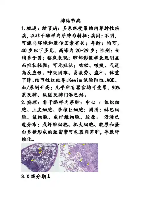 肺结节病的影像学诊断及鉴别诊断