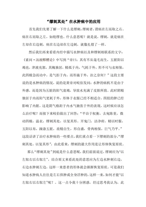 缪刺其处在水肿病中的应用