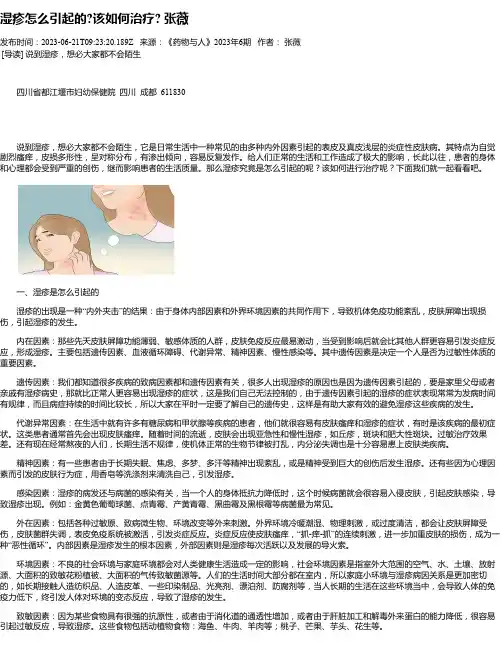 湿疹怎么引起的该如何治疗张薇