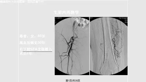 福建医科大学附属第一医院血管外科PPT课件
