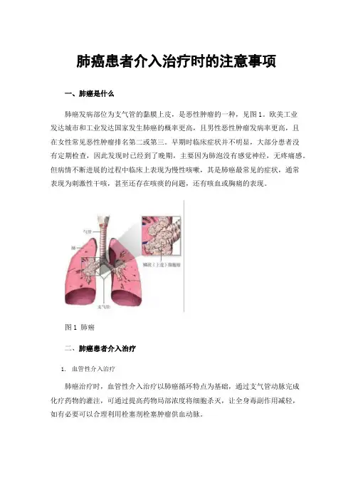 肺癌患者介入治疗时的注意事项
