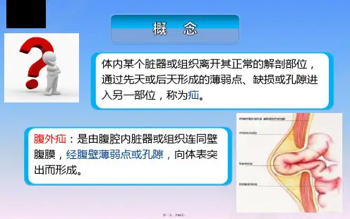《外科护理》第十五章第一节腹外疝病人护理