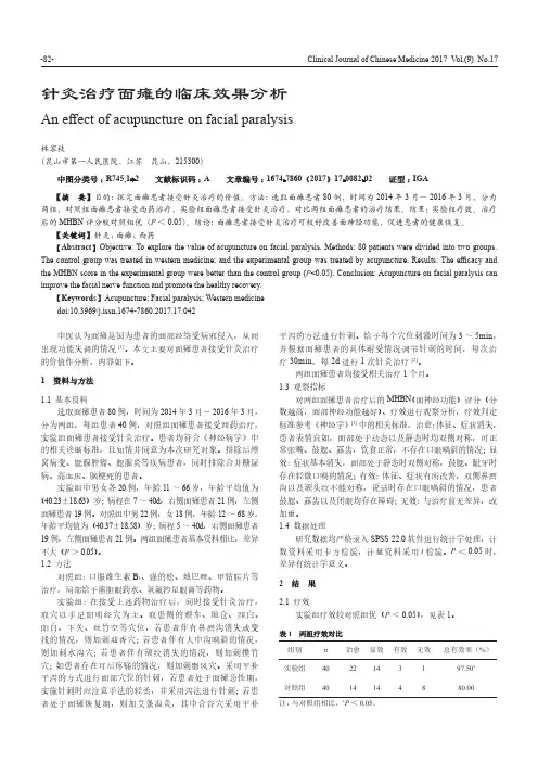 针灸治疗面瘫的临床效果分析