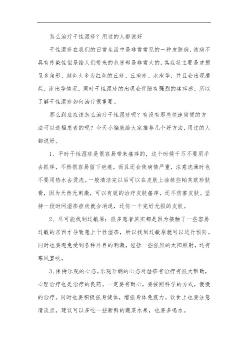 怎么治疗干性湿疹？用过的人都说好
