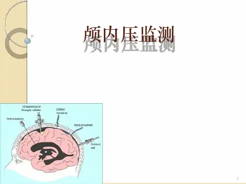 颅内压监测ppt课件