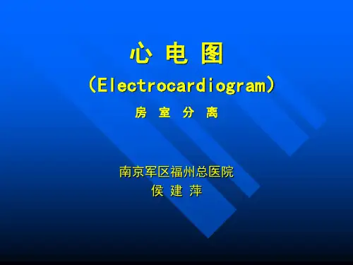 房室分离