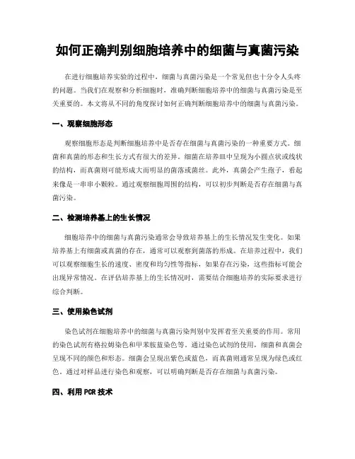 如何正确判别细胞培养中的细菌与真菌污染