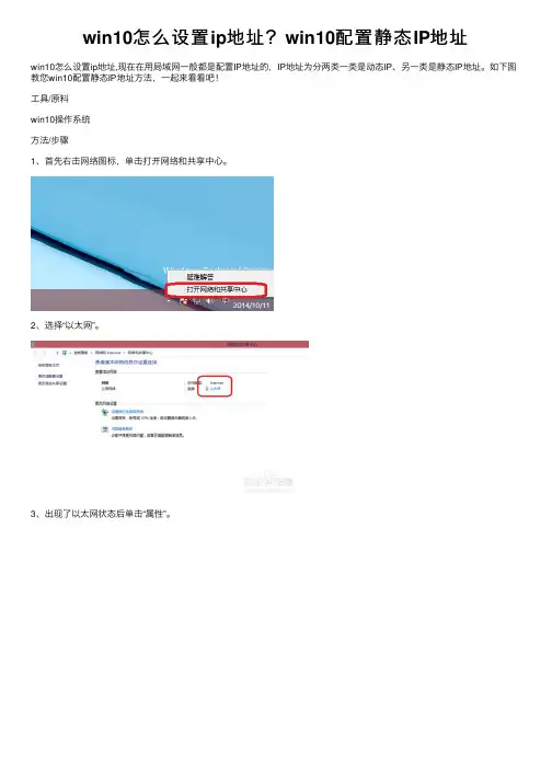 win10怎么设置ip地址？win10配置静态IP地址