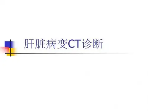 肝脏病变CT诊断-120页PPT资料