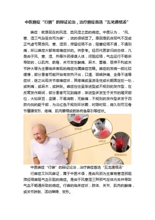中医痹症“行痹”的辩证论治，治疗痹症首选“五龙通络汤”