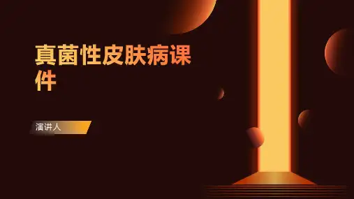 真菌性皮肤病课件