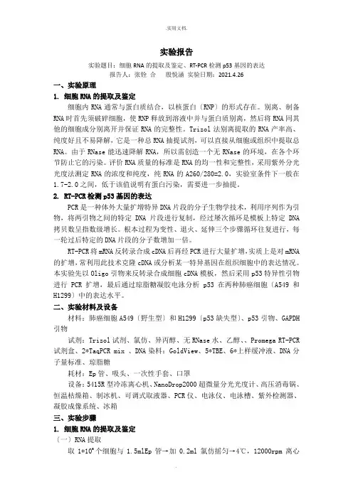 细胞RNA的提取及鉴定、RT-PCR检测p53基因的表达