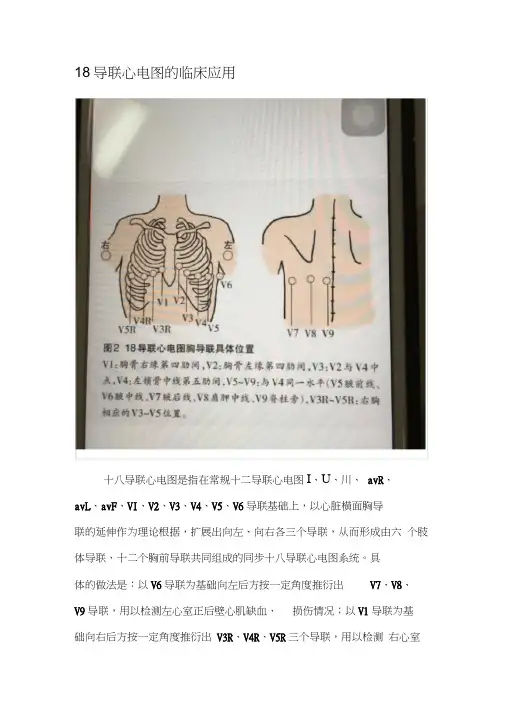 心电图导联
