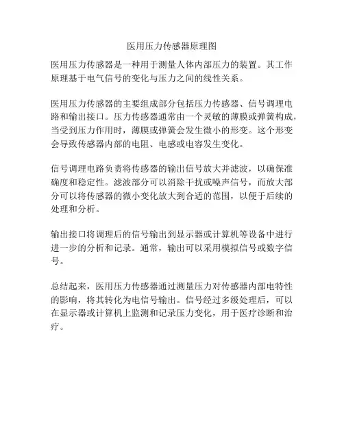 医用压力传感器原理图
