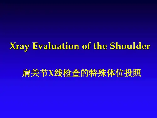 肩关节X线检查的特殊体位投照