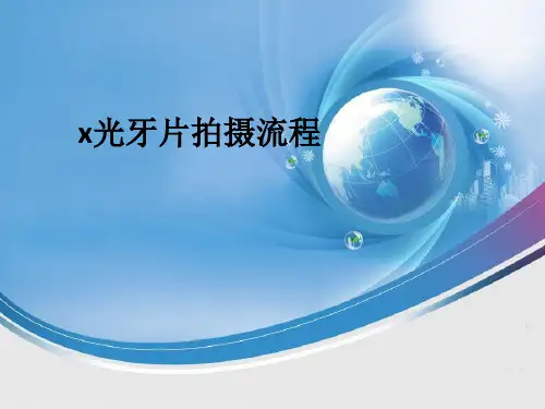 x光牙片拍摄流程ppt课件
