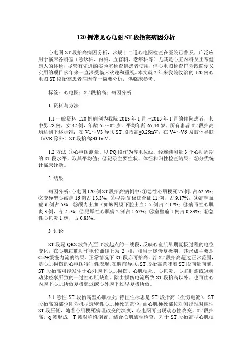120例常见心电图ST段抬高病因分析