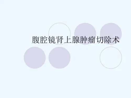 腹腔镜肾上腺肿瘤切除术[可修改版ppt]