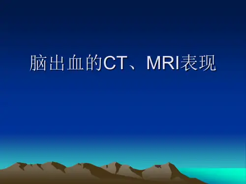 医学影像诊断学：脑出血的CT、MRI表现