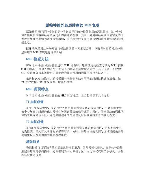 原始神经外胚层肿瘤的MRI表现