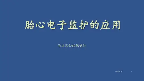 胎心监护基本知识第九版妇产科学 ppt课件