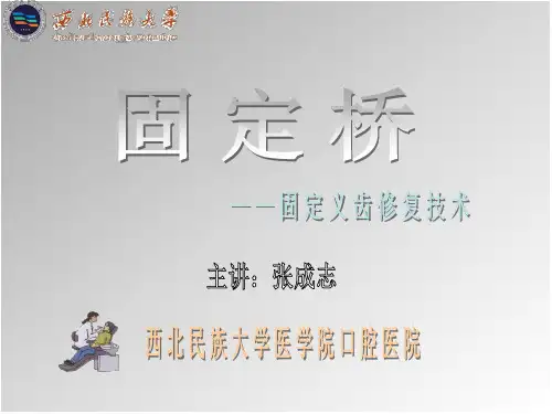 固定桥课件
