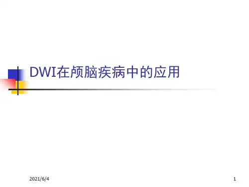 DWI高信号常见疾病的鉴别诊断