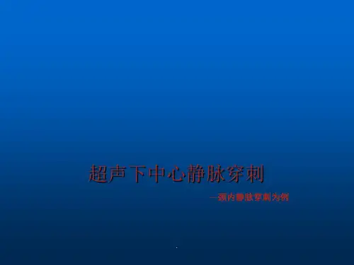 超声下中心静脉穿刺ppt课件
