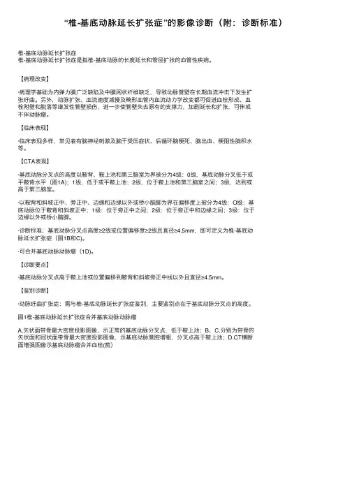 “椎-基底动脉延长扩张症”的影像诊断（附：诊断标准）