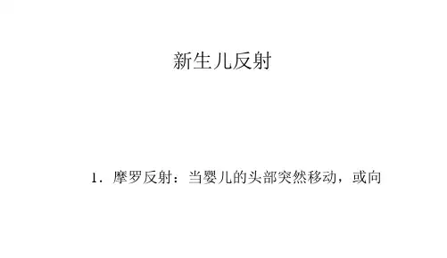 新生儿反射