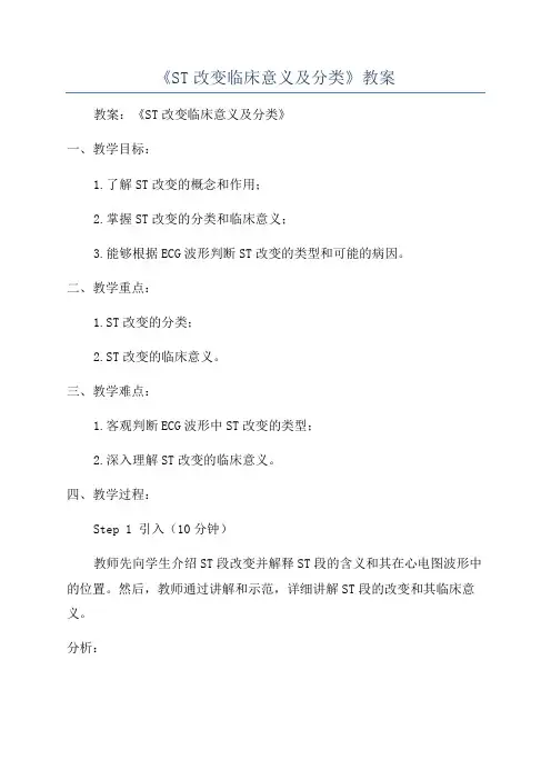 《ST改变临床意义及分类》教案