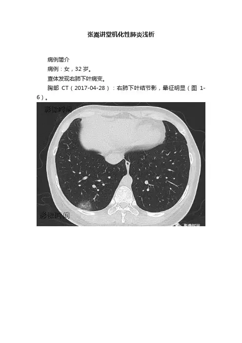 张嵩讲堂机化性肺炎浅析