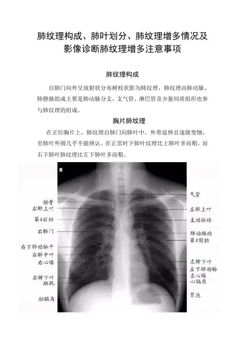 肺纹理构成、肺叶划分、肺纹理增多情况及影像诊断肺纹理增多注意事项