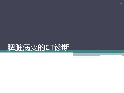 脾脏病变诊断与鉴别诊断