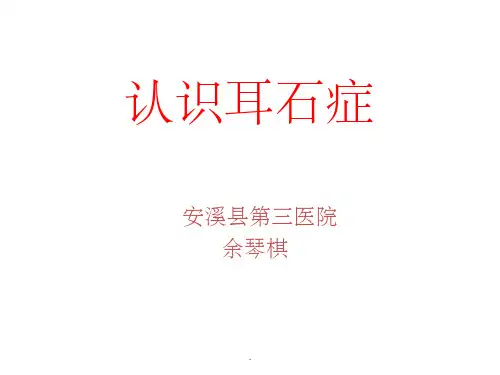 耳石症的诊治PPT课件