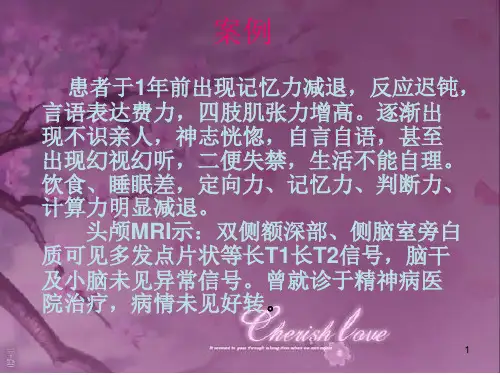阿尔茨海默病PPT参考幻灯片