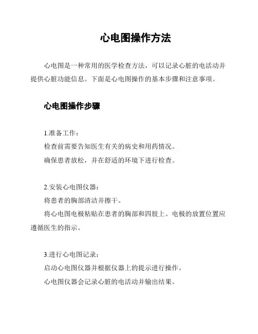 心电图操作方法
