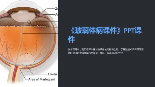 《玻璃体病课件》课件