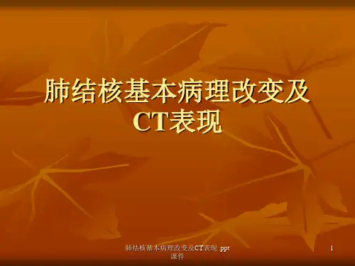 肺结核基本病理改变及CT表现 ppt课件
