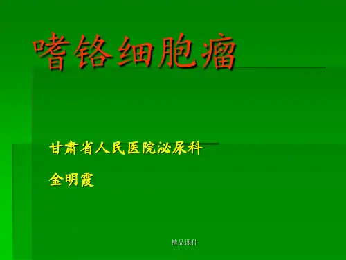 嗜铬细胞瘤
