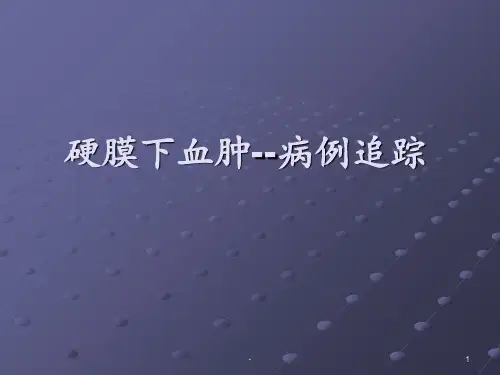 硬膜下血肿护理查房ppt课件