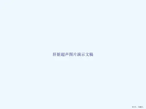 肝脏超声图片演示文稿