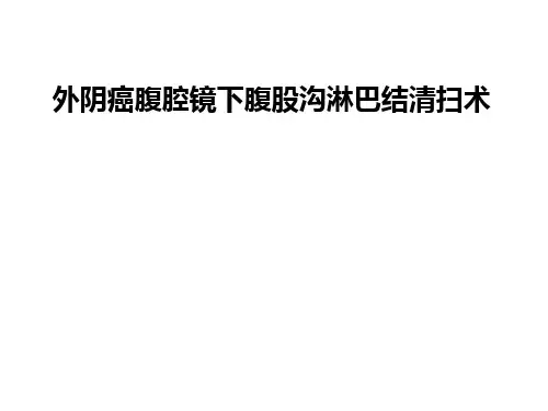 外阴癌腹腔镜下腹股沟淋巴结清扫术