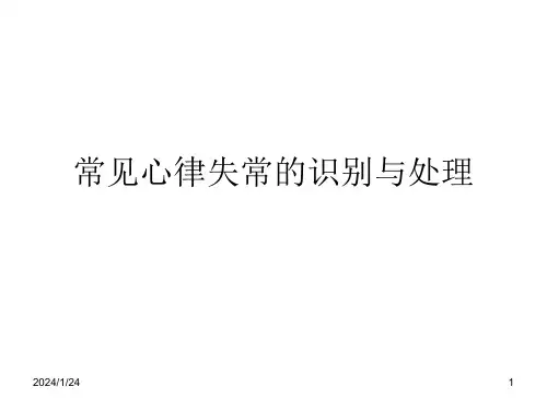 常见心律失常的识别与处理-ppt课件